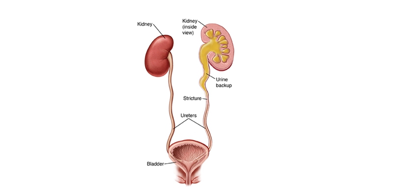 Ureteric-Structure